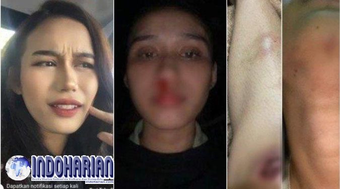 Mahasiswi UPH Dianiaya Pacar, Ini Kata KemenPPA Mahasiswi UPH Dianiaya Pacar, Ini Kata KemenPPA