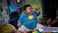 Permalink to Kondisi Terkini Bayi Obesitas di Bekasi