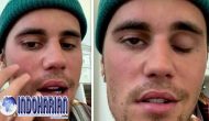 Permalink to Penyakit Ramsay Hunt Syndrome Yang Diderita Justin Bieber
