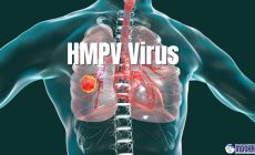 Permalink to Apa Itu Virus HMPV China, Kenali Gejala dan Risikonya