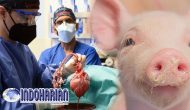 Permalink to Fakta Mengejutkan Pria Penerima Transpalasi Jantung Babi