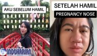 Permalink to Pregnancy Nose Viral Disosmed,  Saat Jelang Lahiran