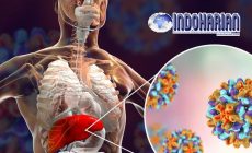 Permalink to Mengerikan!!Virus Hepatitis Masuk Indonesia